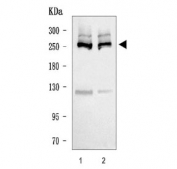 Western blot testing of human 1) HeLa and 2) Jurkat cell lysate with Acetyl CoA Carboxylase 1 antibody. Observed molecular weight ~260 kDa.