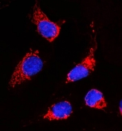 Immunofluorescent staining of FFPE human U-2 OS cells with Acetyl CoA Carboxylase 1 antibody (red) and DAPI nuclear stain (blue). HIER: steam section in pH6 citrate buffer for 20 min.