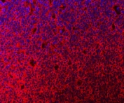 Immunofluorescent staining of FFPE human tonsil tissue with C-1-tetrahydrofolate synthase antibody (red) and DAPI nuclear stain (blue). HIER: steam section in pH8 EDTA buffer for 20 min.