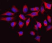 Immunofluorescent staining of FFPE human HeLa cells with C-1-tetrahydrofolate synthase antibody (red) and DAPI nuclear stain (blue). HIER: steam section in pH6 citrate buffer for 20 min.