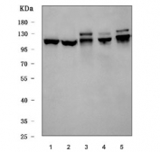 Western blot testing of 1) human HeLa, 2) human 293T, 3) rat brain, 4) mouse brain and 5) mouse kidney tissue lysate with C-1-tetrahydrofolate synthase antibody. Predicted molecular weight ~102 kDa.