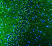 Immunofluorescent staining of FFPE rat brain tissue with EAAT1 antibody (green) and DAPI nuclear stain (blue). HIER: steam section in pH8 EDTA buffer for 20 min.