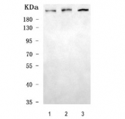 Western blot testing of 1) human HeLa, 2) human A549 and 3) rat brain tissue lysate with DEP1 antibody. Predicted molecular weight ~146 kDa but observed at up to ~250 kDa due to glycosylation.