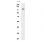 Wester blot testing of mouse stomach tissue lysate with Ppp1r15a antibody. Predicted molecular weight ~73 kDa, but commonly observed at up to ~110 kDa.