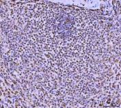 IHC staining of FFPE human spleen tissue with FIP1L1 antibody. HIER: boil tissue sections in pH8 EDTA for 20 min and allow to cool before testing.