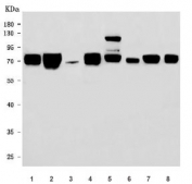 Western blot testing of 1) human HeLa, 2) human K562, 3) human Jurkat, 4) human MOLT4, 5) rat brain, 6) rat liver, 7) mouse brain and 8) mouse liver tissue lysate with FIP1L1 antibody. Predicted molecular weight ~67 kDa.
