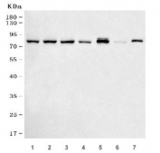 Western blot testing of 1) human HepG2, 2) human HeLa, 3) human U-87 MG, 4) human MCF7, 5) rat liver, 6) rat C6 and 7) mouse liver tissue lysate with ACSS2 antibody. Predicted molecular weight ~79 kDa.