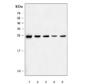 Western blot testing of 1) human Jurkat, 2) human HeLa, 3) human HepG2, 4) human K562 and 5) mouse liver tissue lysate with BAG2 antibody. Predicted molecular weight ~22 kDa.