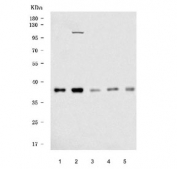 Western blot testing of 1) human HepG2, 2) human U-251, 3) human PC-3, 4) human A549 and 5) rat testis tissue lysate with DNAJB1 antibody. Expected molecular weight ~40 kDa.