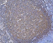 IHC staining of FFPE human tonsil tissue with TOMM40 antibody. HIER: boil tissue sections in pH8 EDTA for 20 min and allow to cool before testing.