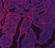 Immunofluorescent staining of FFPE human colon cancer tissue with ERP29 antibody (red) and DAPI nuclear stain (blue). HIER: steam section in pH8 EDTA buffer for 20 min.
