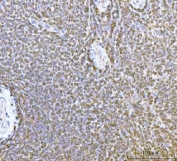 IHC staining of FFPE human spleen tissue with ERP29 antibody. HIER: boil tissue sections in pH8 EDTA for 20 min and allow to cool before testing.