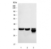 Western blot testing of human 1) HeLa, 2) U-87 MG and 3) A431 cell lysate with Malate dehydrogenase 2 antibody. Predicted molecular weight ~35 kDa.