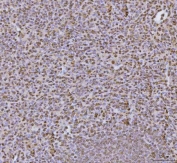 IHC staining of FFPE human spleen tissue with hnRNP U antibody. HIER: boil tissue sections in pH8 EDTA for 20 min and allow to cool before testing.