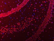 Immunofluorescent staining of FFPE rat brain tissue with hnRNP U antibody (red) and DAPI nuclear stain (blue). HIER: steam section in pH8 EDTA buffer for 20 min.