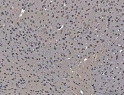 IHC staining of FFPE mouse brain tissue with hnRNP U antibody. HIER: boil tissue sections in pH8 EDTA for 20 min and allow to cool before testing.