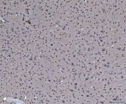 IHC staining of FFPE rat brain tissue with hnRNP U antibody. HIER: boil tissue sections in pH8 EDTA for 20 min and allow to cool before testing.