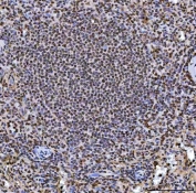 IHC staining of FFPE human spleen tissue with HNRPL antibody. HIER: boil tissue sections in pH8 EDTA for 20 min and allow to cool before testing.