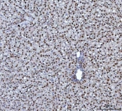 IHC staining of FFPE rat liver tissue with HNRPL antibody. HIER: boil tissue sections in pH8 EDTA for 20 min and allow to cool before testing.
