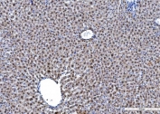 IHC staining of FFPE mouse liver tissue with HNRPL antibody. HIER: boil tissue sections in pH8 EDTA for 20 min and allow to cool before testing.