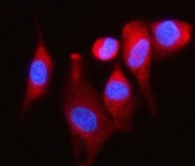Immunofluorescent staining of FFPE human U-87 MG cells with DAP5 antibody (red) and DAPI nuclear stain (blue). HIER: steam section in pH6 citrate buffer for 20 min.