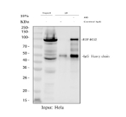 Immunoprecipitation of DAP5 protein from 500ug of human HeLa whole cell lysate with 2ug of DAP5 antibody.