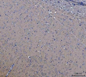 IHC staining of FFPE mouse brain tissue with STK24 antibody. HIER: boil tissue sections in pH8 EDTA for 20 min and allow to cool before testing.