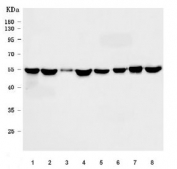 Western blot testing of human 1) A431, 2) HeLa, 3) Raji, 4) U-87 MG, 5) 293T, 6) placenta, 7) Caco-2 and 8) RT4 cell lysate with STK24 antibody. Predicted molecular weight ~49 kDa.