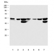 Western blot testing of 1) rat stomach, 2) rat testis, 3) rat brain, 4) mouse stomach, 5) mouse small intestine, 6) mouse testis and 7) mouse brain tissue lysate with STK24 antibody. Predicted molecular weight ~49 kDa.