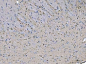 IHC staining of FFPE rat brain tissue with STK24 antibody. HIER: boil tissue sections in pH8 EDTA for 20 min and allow to cool before testing.