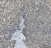 IHC staining of FFPE human spleen tissue with CFIm68 antibody. HIER: boil tissue sections in pH8 EDTA for 20 min and allow to cool before testing.