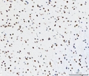 IHC staining of FFPE mouse brain tissue with CFIm68 antibody. HIER: boil tissue sections in pH8 EDTA for 20 min and allow to cool before testing.