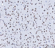 IHC staining of FFPE rat brain tissue with CFIm68 antibody. HIER: boil tissue sections in pH8 EDTA for 20 min and allow to cool before testing.