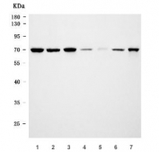 Western blot testing of 1) human HeLa, 2) human 293T, 3) monkey COS-7, 4) rat brain, 5) rat thymus, 6) mouse brain and 7) mouse thymus tissue lysate with CFIm68 antibody. Predicted molecular weight: 52-63 kDa (multiple isoforms).