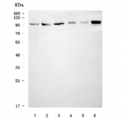 Western blot testing of 1) human HepG2, 2) human RT4, 3) human SH-SY5Y, 4) rat liver, 5) mouse small intestine and 6) mouse liver tissue lysate with VPS41 antibody. Predicted molecular weight: 93-98 kDa (multiple isoforms).
