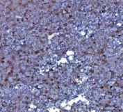 IHC staining of FFPE mouse thymus tissue with XCR1 antibody. HIER: boil tissue sections in pH8 EDTA for 20 min and allow to cool before testing.