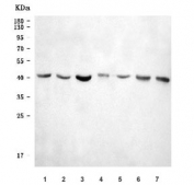 Western blot testing of 1) human RT4, 2) human U-87 MG, 3) human HEL, 4) human U-2 OS, 5) rat spleen, 6) mouse spleen and 7) mouse thymus tissue lysate with XCR1 antibody. Predicted molecular weight ~39 kDa.