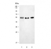 Western blot testing of 1) human 293T, 2) rat brain and 3) mouse brain tissue lysate with ARL13B antibody. Predicted molecular weight: 37-49 kDa (multiple isoforms).