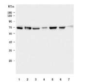 Western blot testing of human 1) 293T, 2) PC-3, 3) HeLa, 4) HL60, 5) HepG2, 6) Daudi and 7) A431 cell lysate with NCOA4 antibody. Expected molecular weight ~70 kDa.