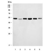Western blot testing of 1) human HeLa, 2) human HepG2, 3) human U937, 4) human Daudi, 5) rat kidney and 6) mouse kidney tissue lysate with MAT2A antibody. Predicted molecular weight ~44 kDa.