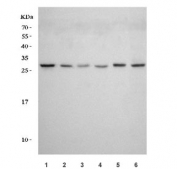 Western blot testing of 1) human 293T, 2) human MCF7, 3) human Jurkat, 4) human HepG2, 5) rat brain and 6) mouse brain tissue lysate with RAB23 antibody. Predicted molecular weight: ~27 kDa.