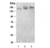 Western blot testing of 1) human MOLT4, 2) rat C6 and 3) mouse EL-4 cell lysate with ZMYM2 antibody. Predicted molecular weight ~155 kDa.