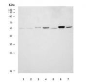 Western blot testing of 1) human U-87 MG, 2) human ThP-1, 3) human HL60, 4) rat pancreas, 5) rat testis, 6) mouse pancreas and 7) mouse testis tissue lysate with DNAJC3 antibody. Predicted molecular weight ~58 kDa.