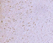 IHC staining of FFPE rat brain tissue with CLASP1 antibody. HIER: boil tissue sections in pH8 EDTA for 20 min and allow to cool before testing.
