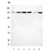 Western blot testing of 1) human U-87 MG, 2) human HeLa, 3) human HEL, 4) human K562, 5) rat brain and 6) rat C6 cell lysate with CLASP1 antibody. Expected molecular weight: 162-169 kDa (multiple isoforms).