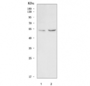 Western blot testing of human 1) K562 and 2) PC-3 cell lysate with Vaccinia-related kinase 2 antibody. Predicted molecular weight: 44-58 kDa (multiple isoforms).