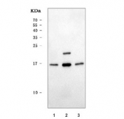 Wester blot testing of human 1) HepG2, 2) K562 and 3) HeLa cell lysate with PUMA antibody. Predicted molecular weight: 20-21 kDa (PUMA alpha) and 14-15 kDa (PUMA beta).