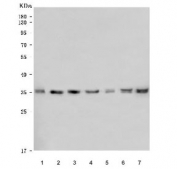 Western blot testing of 1) human 293T, 2) human U-251, 3) human PC-3, 4) human U-87 MG, 5) rat stomach, 6) mouse RAW264.7 and 7) mouse NIH 3T3 cell lysate with AIDA antibody. Predicted molecular weight ~35 kDa.