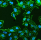 Immunofluorescent staining of FFPE human U-2 OS cells with LIMA1 antibody (green) and DAPI nuclear stain (blue). HIER: steam section in pH6 citrate buffer for 20 min.