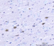 IHC staining of FFPE rat brain tissue with Adgrg1 antibody. HIER: boil tissue sections in pH8 EDTA for 20 min and allow to cool before testing.